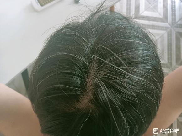 ”不知死活就继续撸，楼主15-25，10年废了