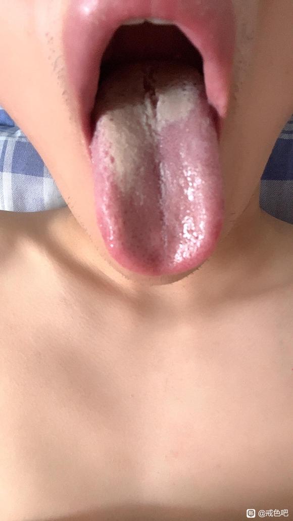 ”跪求看下舌苔