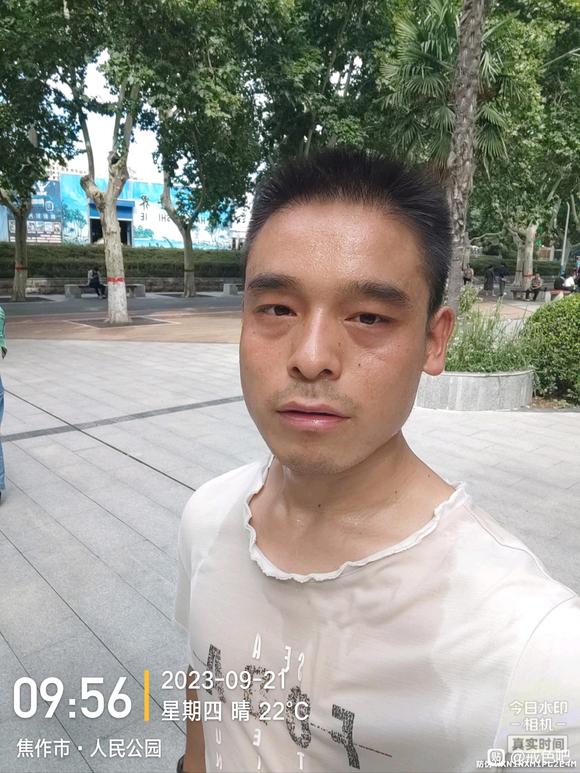 ”希望通过戒色,改善眼袋黑眼圈