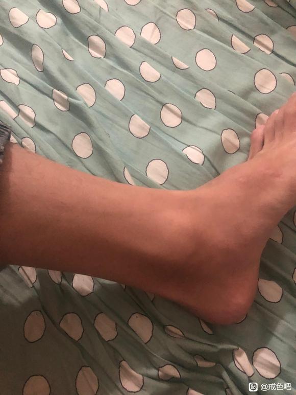 ”手掌缝里都没肉