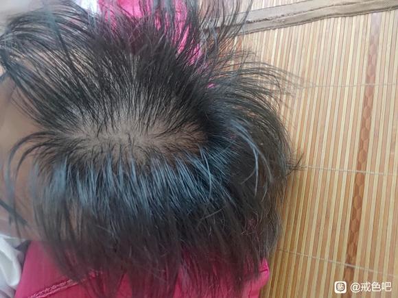 ”戒了快3个月了