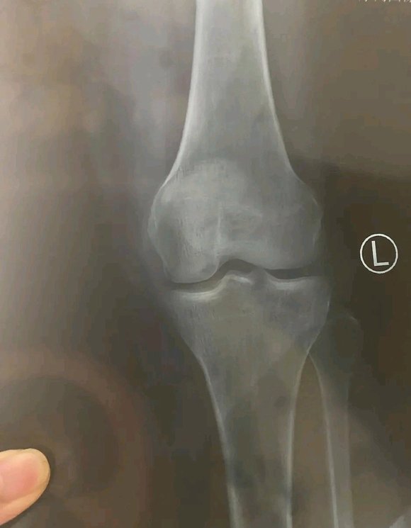 ”有没有人愿意信我，帮我，施舍我，能给我买点大米嘛！因为意外（