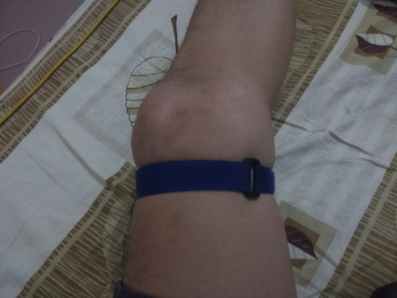 ”关于解决遗精问题的实用方法