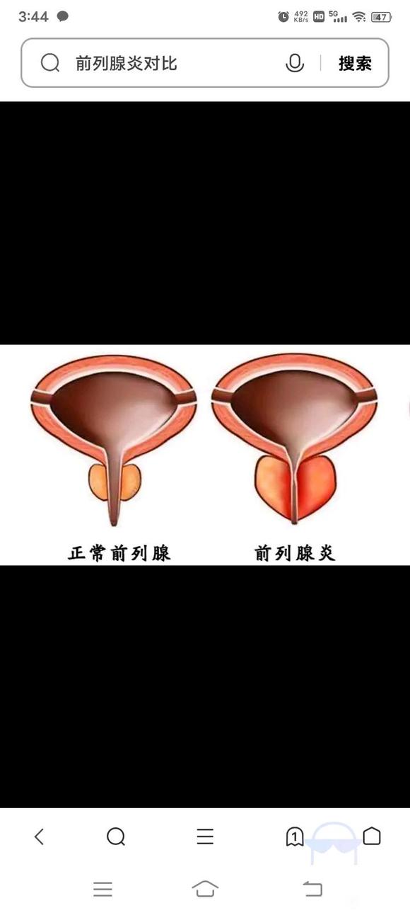 ”上厕所难受好烦啊