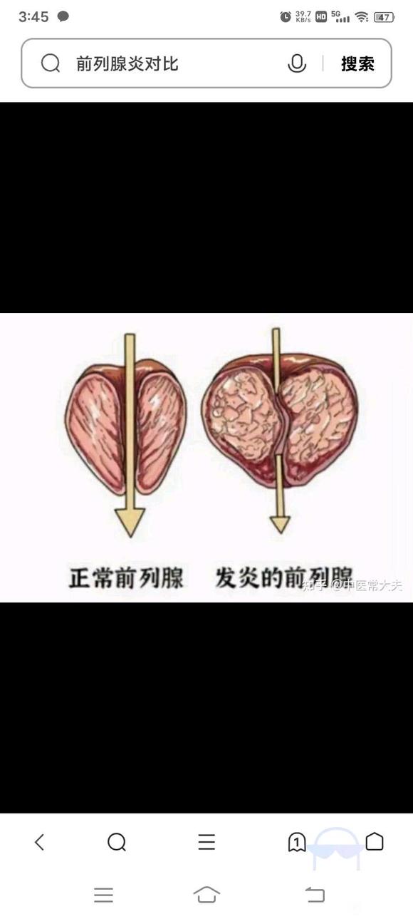 ”上厕所难受好烦啊