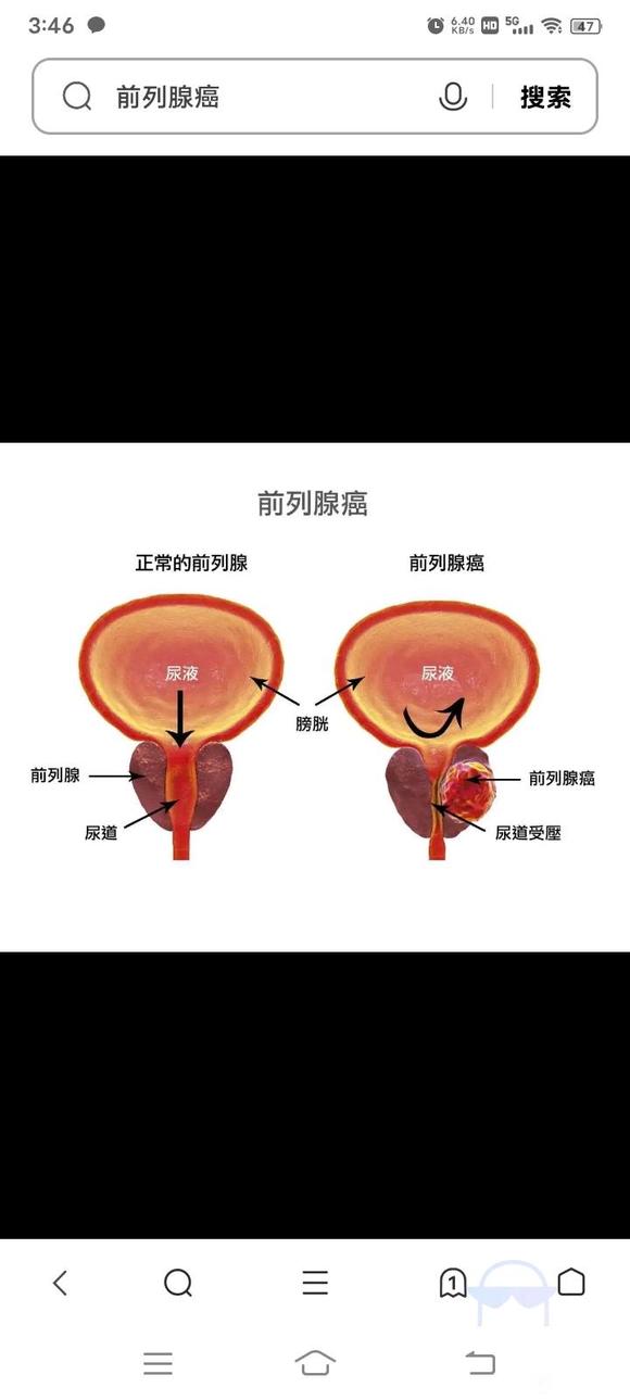 ”上厕所难受好烦啊