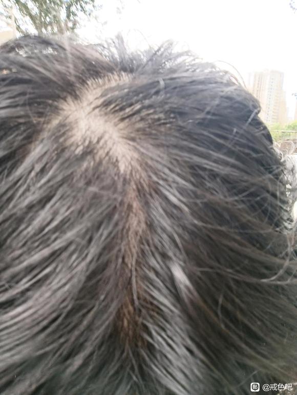 ”师兄们我这脱发怎么办