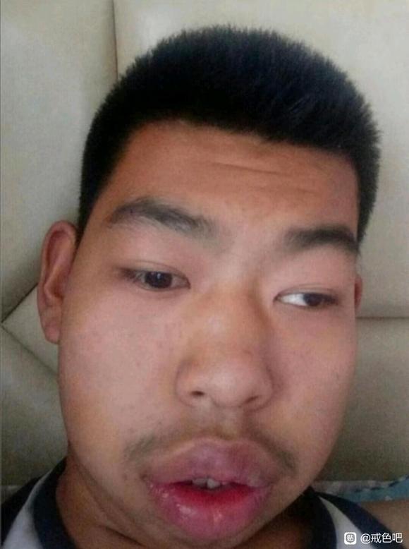 ”撸了九年开始反噬了