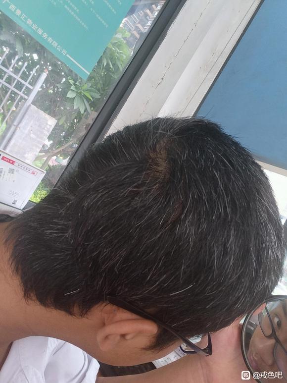 ”戒色头发会变好吗？