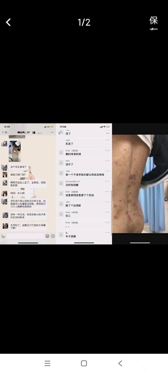 ”戒色恢复怎么样