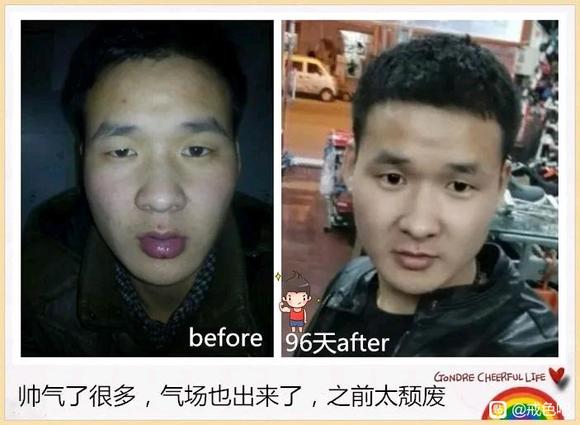 ”分享前后对比图1