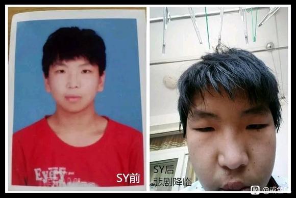 ”分享前后对比图1