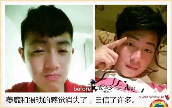 ”分享前后对比图1