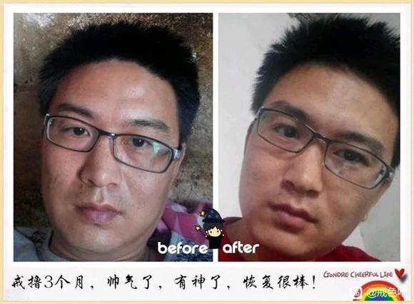 ”分享前后对比图1