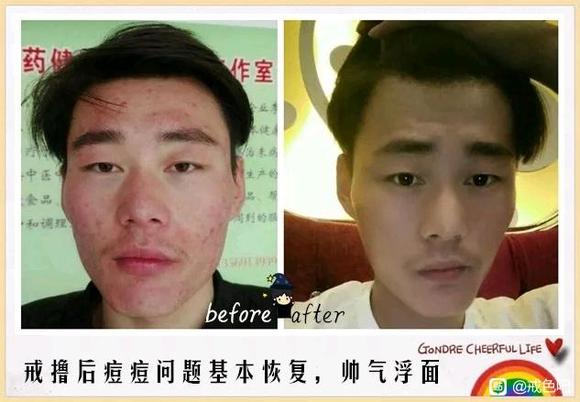 ”分享前后对比图1