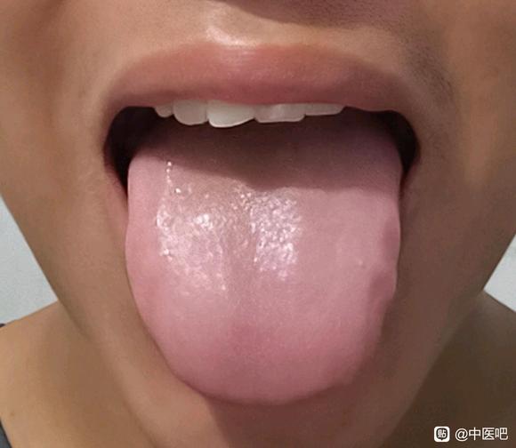 ”【发帖先看置顶】黑眼圈求助！！！