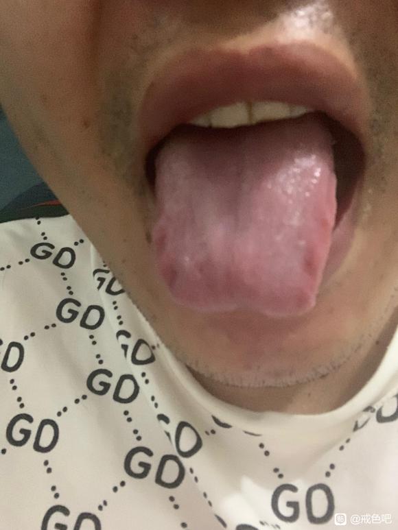 ”干活有点气短、头有点昏昏沉沉