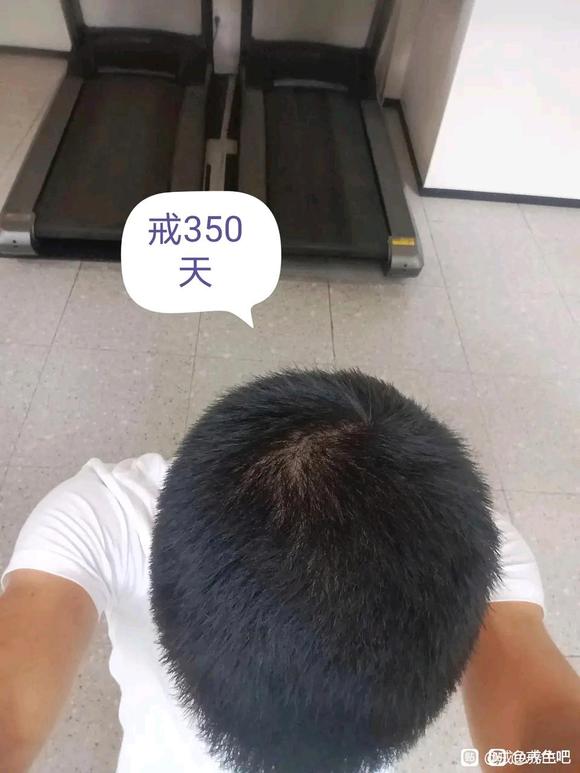 ”戒色养生，头发恢复，早泄恢复