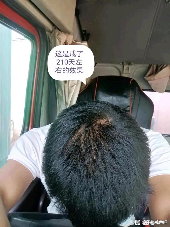 ”戒色养生，头发恢复，早泄恢复