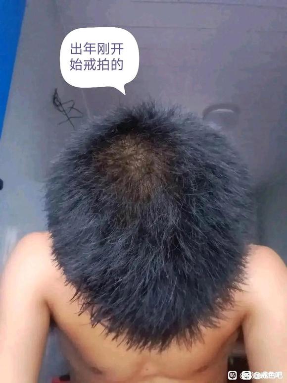 ”戒色养生，头发恢复，早泄恢复