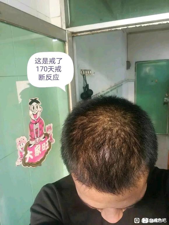 ”戒色养生，头发恢复，早泄恢复