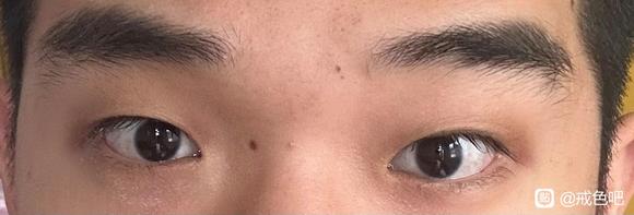 ”戒色十五天眼睛恢复的怎么样