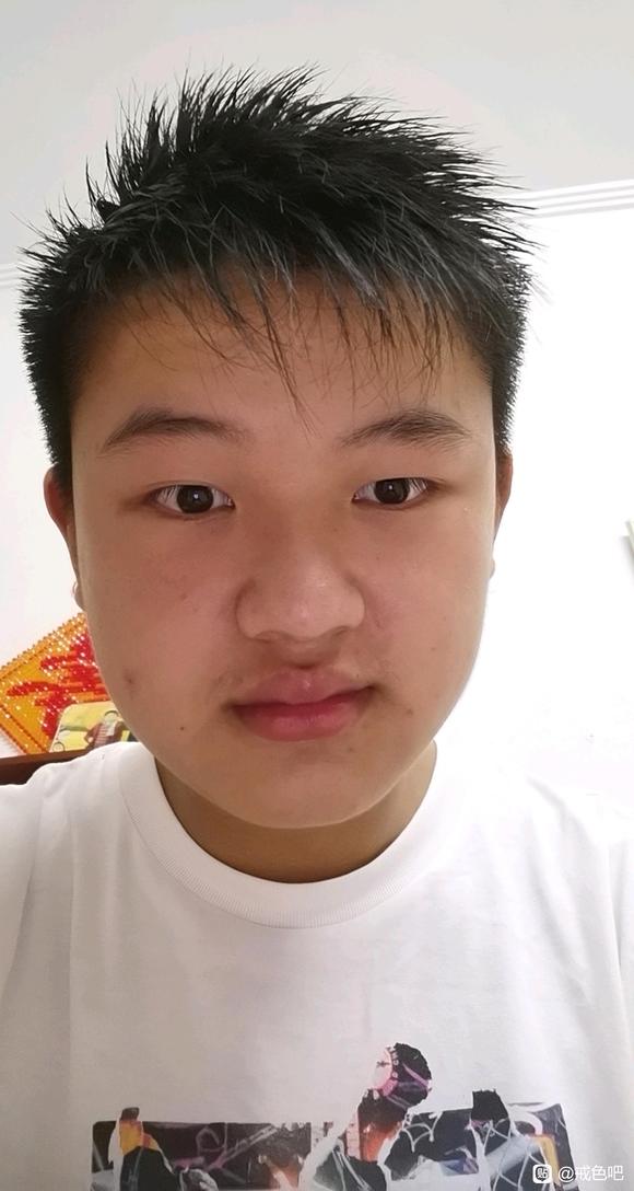 ”SY九个月，诸位看我伤的深吗？