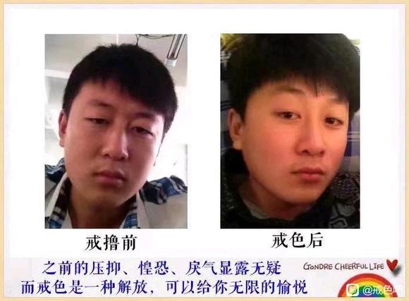 ”关于条件反射漏的问题