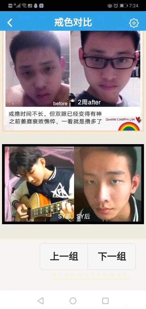 ”关于条件反射漏的问题