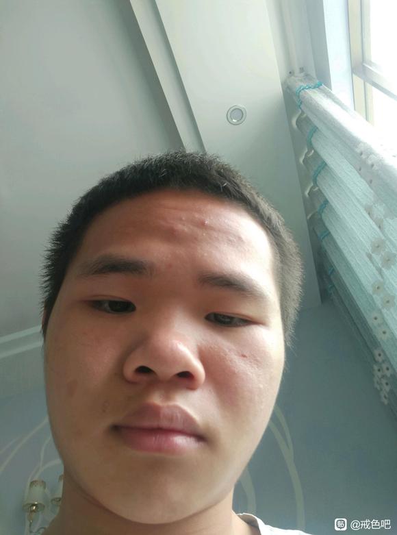 ”十一个月的成果！照片前后对比