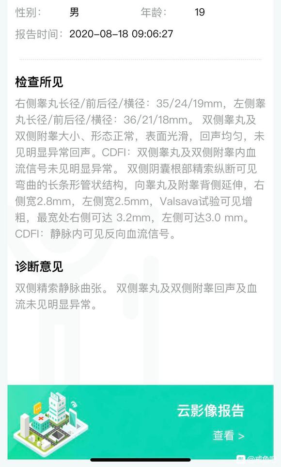 ”今天去医院检查出双侧精索静脉曲张！