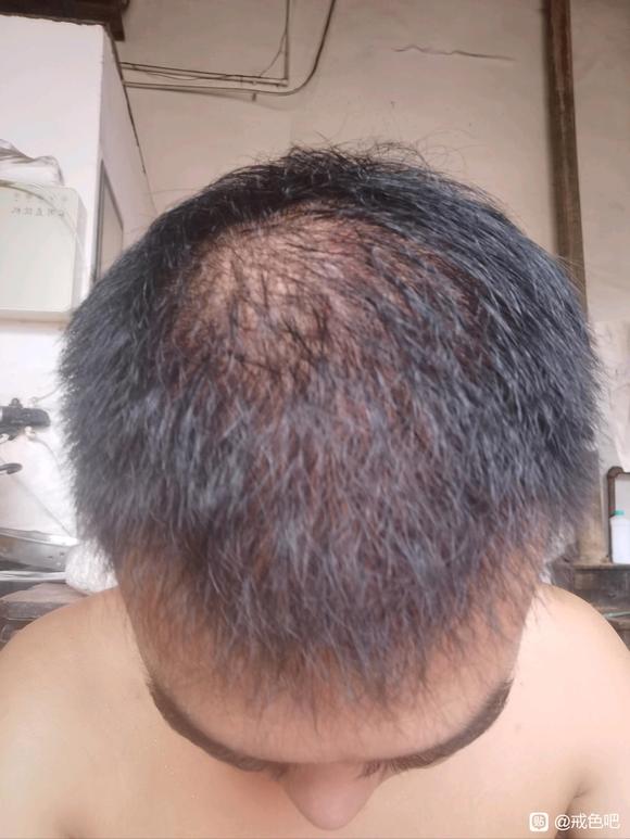 ”以我为例子吧