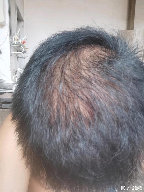 ”以我为例子吧