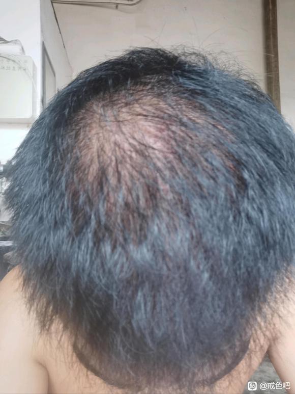 ”以我为例子吧