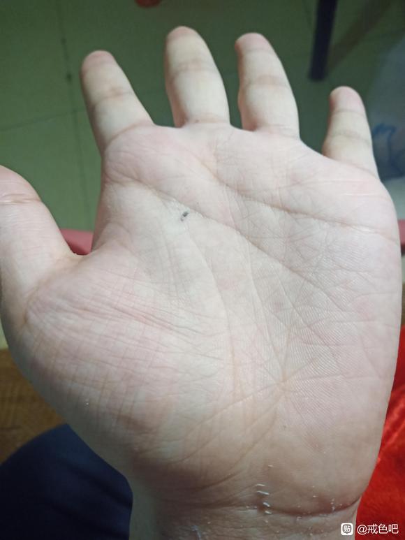 ”因为学习压力大sy几年了，突然发现全身肉跳且双手怪怪的