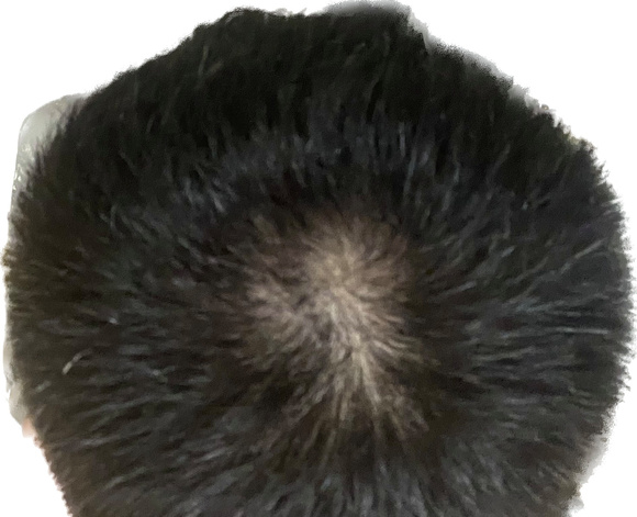 ”19岁，还有救吗