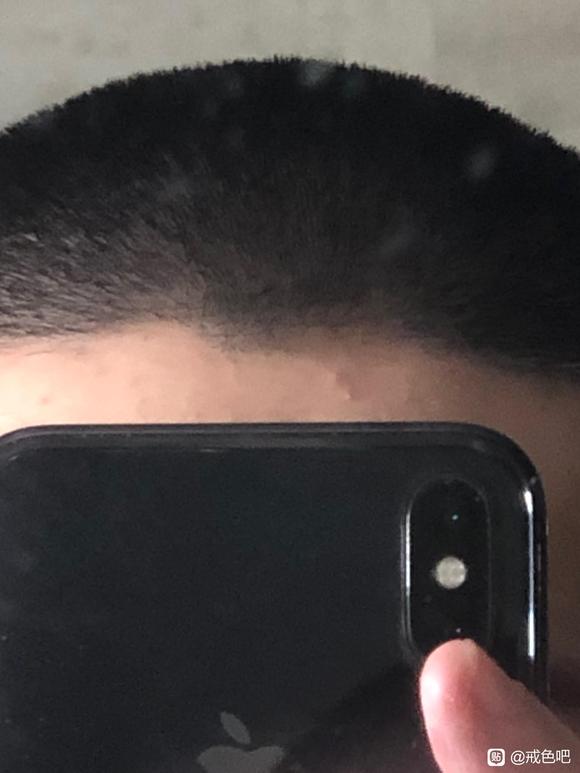 ”想问问各位戒友，我这是要掉头发了吗