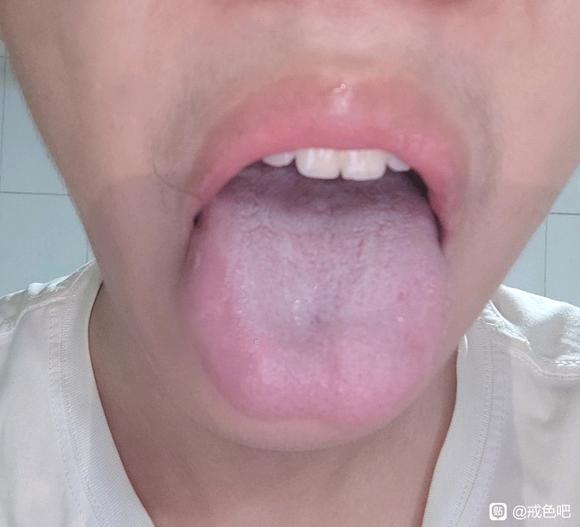 ”腰疼睡不着觉