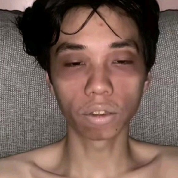 ”有什么好的恢复方法吗各位？有的私信我一下