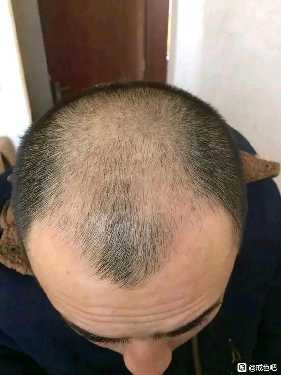 ”戒se五年，完全的蜕变重生！