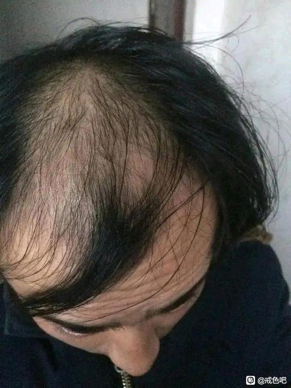 ”戒se五年，完全的蜕变重生！