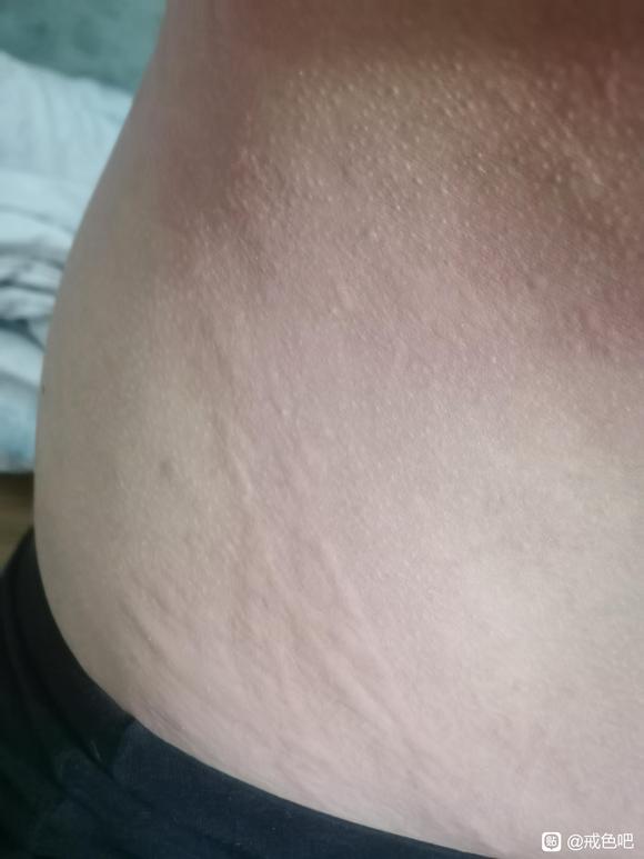 ”又添新毛病。