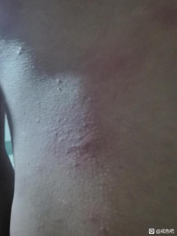 ”又添新毛病。