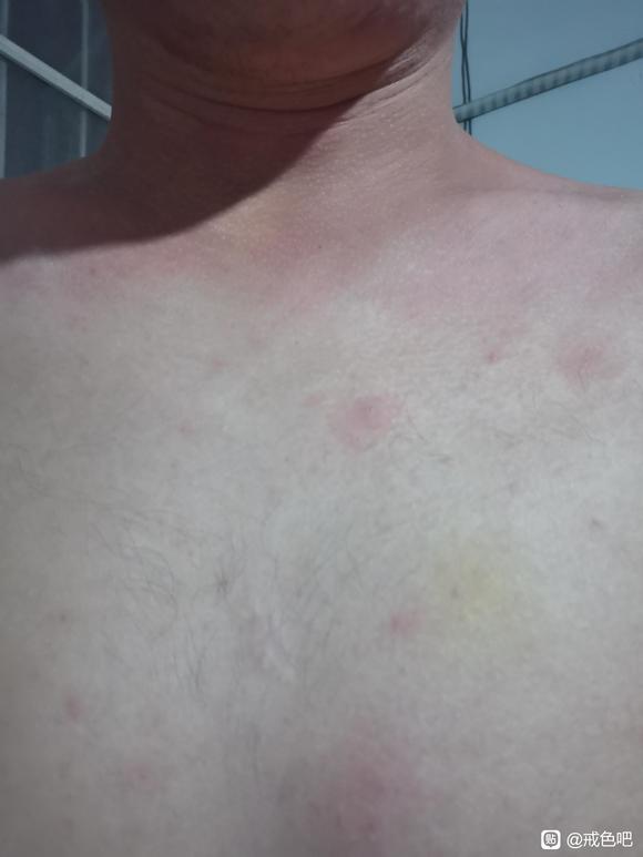 ”又添新毛病。