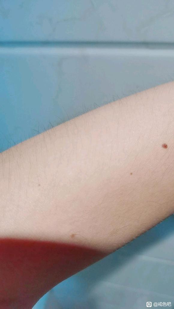 ”最近身上脸上感觉长了很多小痣，和戒色有关吗