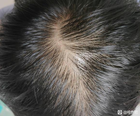 ”吧友们，还能恢复吗？