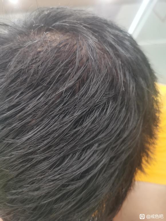 ”恢复问题求助