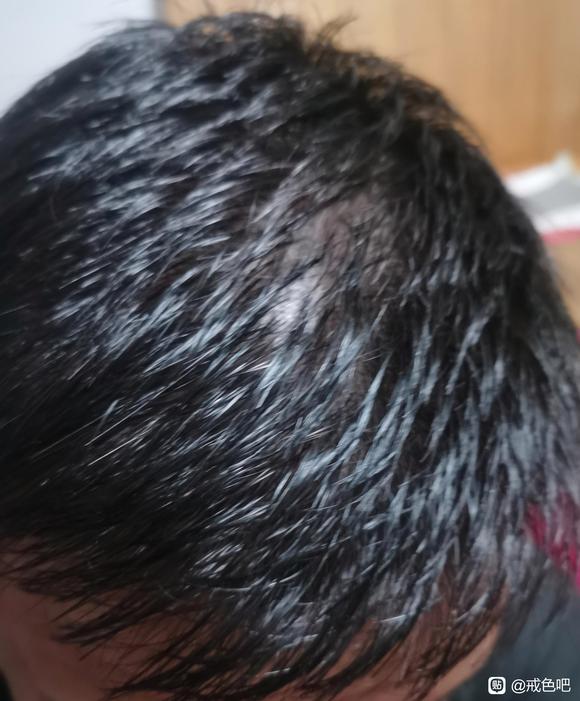 ”恢复问题求助