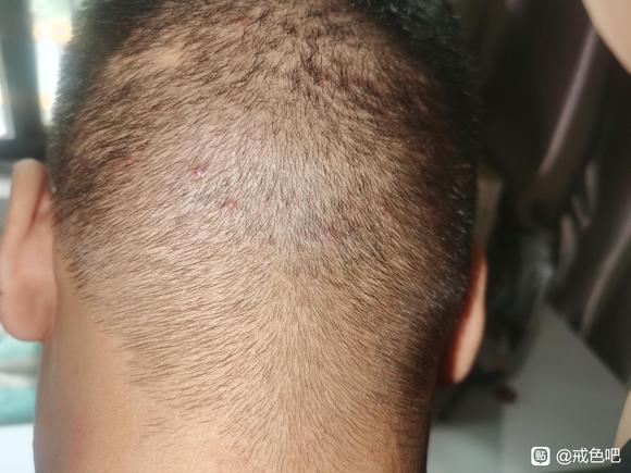 ”恢复问题求助