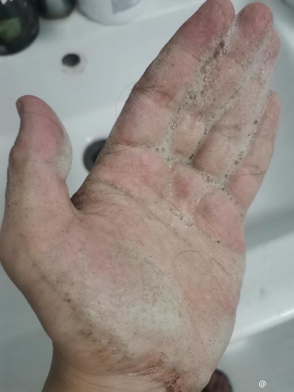 ”恢复问题求助